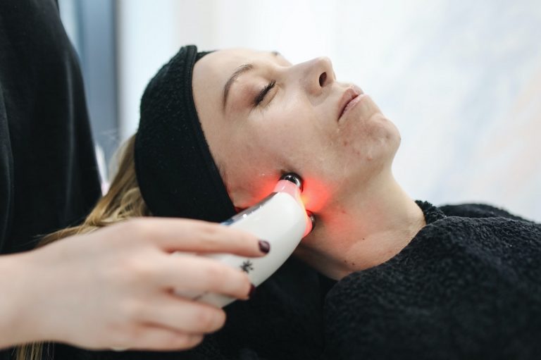 Epilazione laser costi e benefici